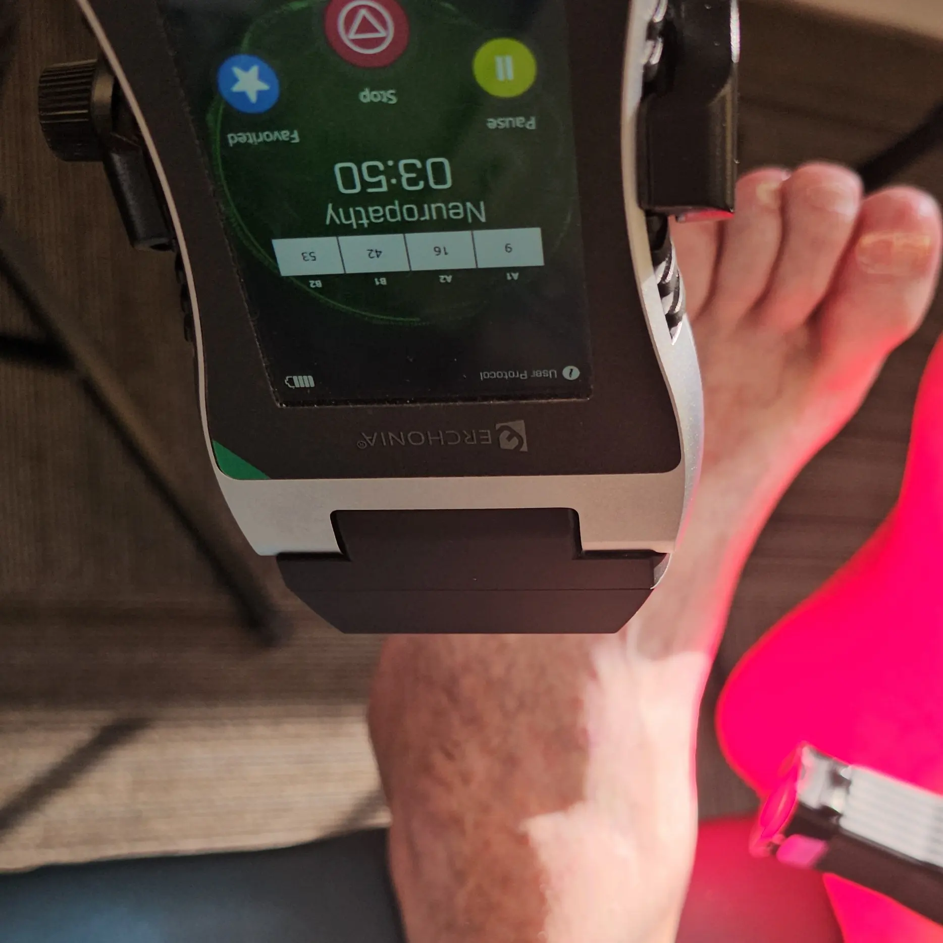 A medical device displaying "Neuropathy" and a timer is positioned over a person's foot, which is illuminated by red light.